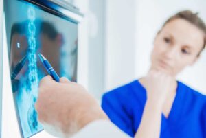 Radiographie illustrant une cyphose dorsale, une condition médicale.