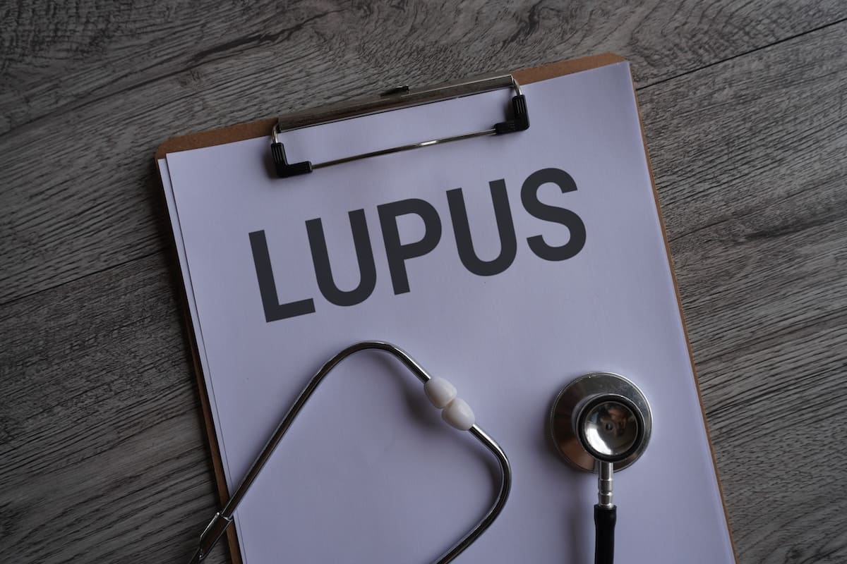 Illustration d'une personne souffrant de lupus avec des documents médicaux